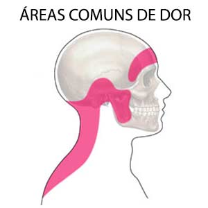 Resultado de imagem para cabeÃ§a e nuca