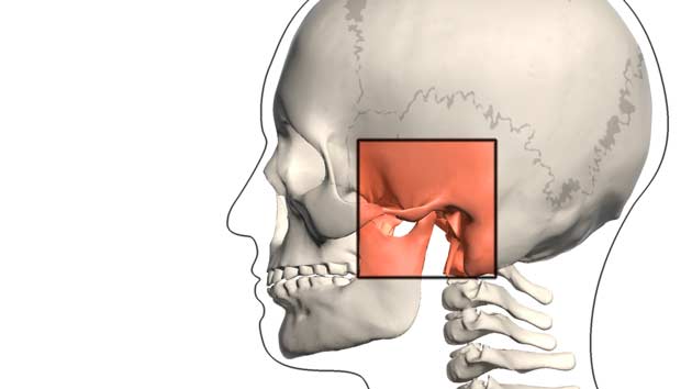 Quando a cirurgia da ATM falha - Portal Patologia da ATM